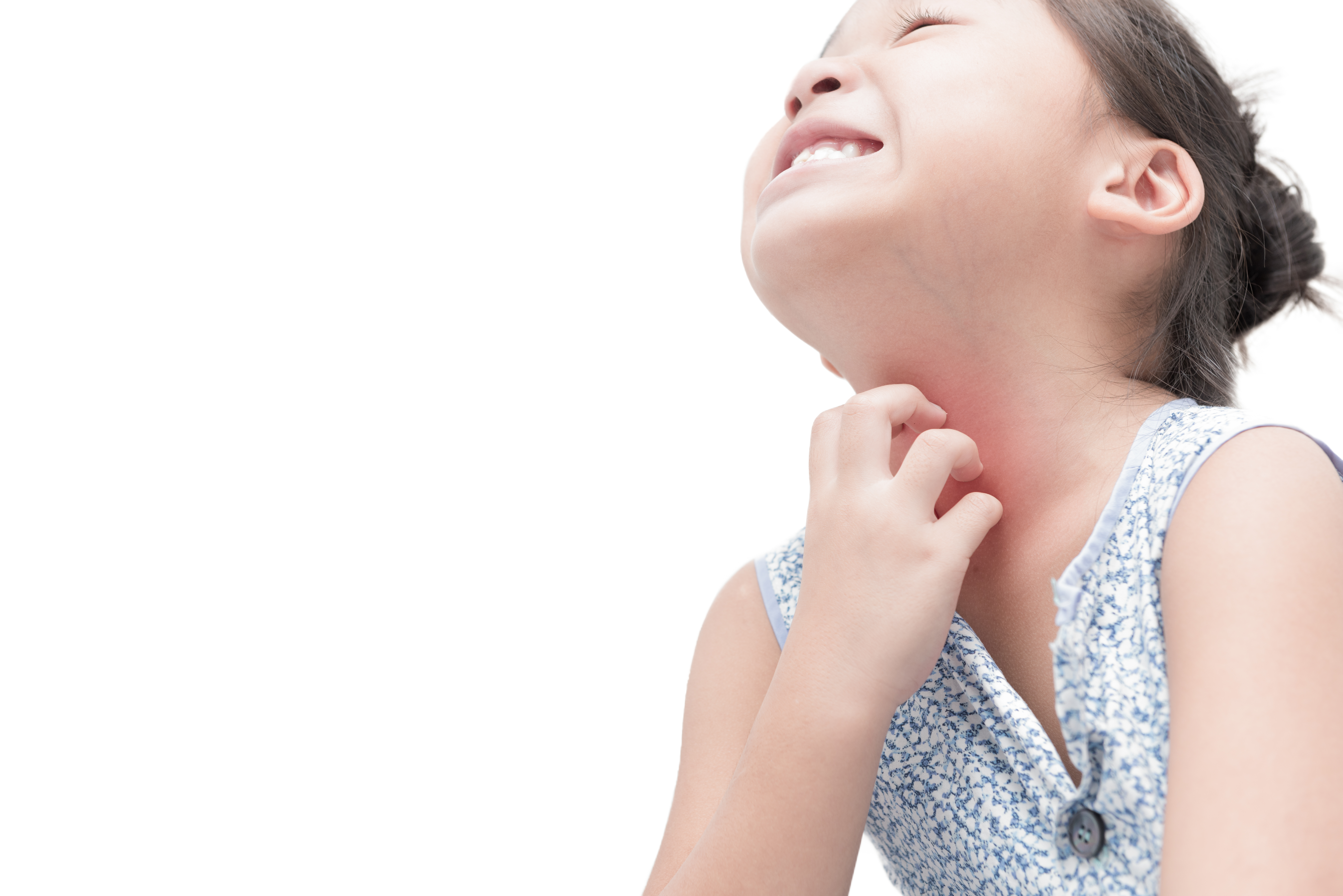 an image of a girl scratching due to food allergies in children